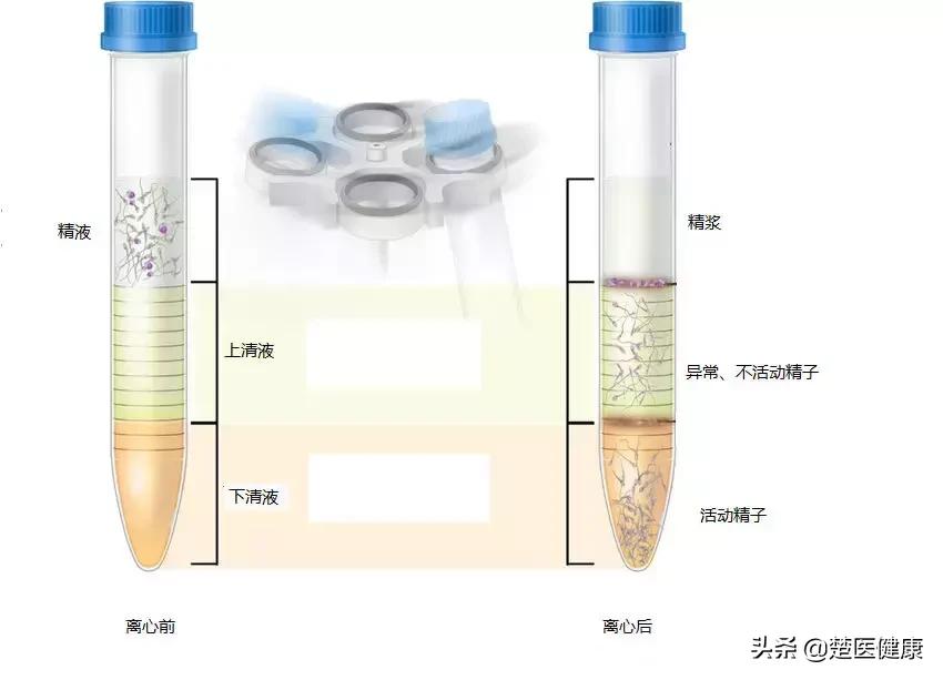 生殖科医生讲述：我在取精室里的秘密……