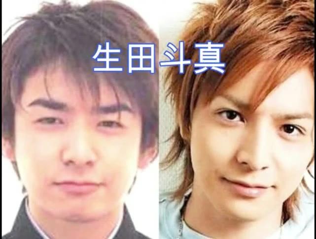 日本整容惊人案例,日本整容是不是最先进