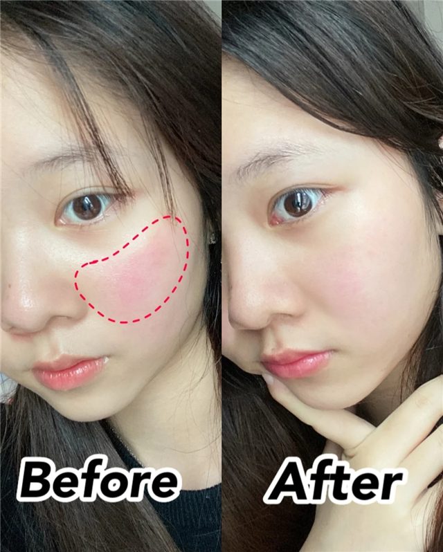 一见到女生就会脸红怎么回事,一出门脸就泛红怎么回事