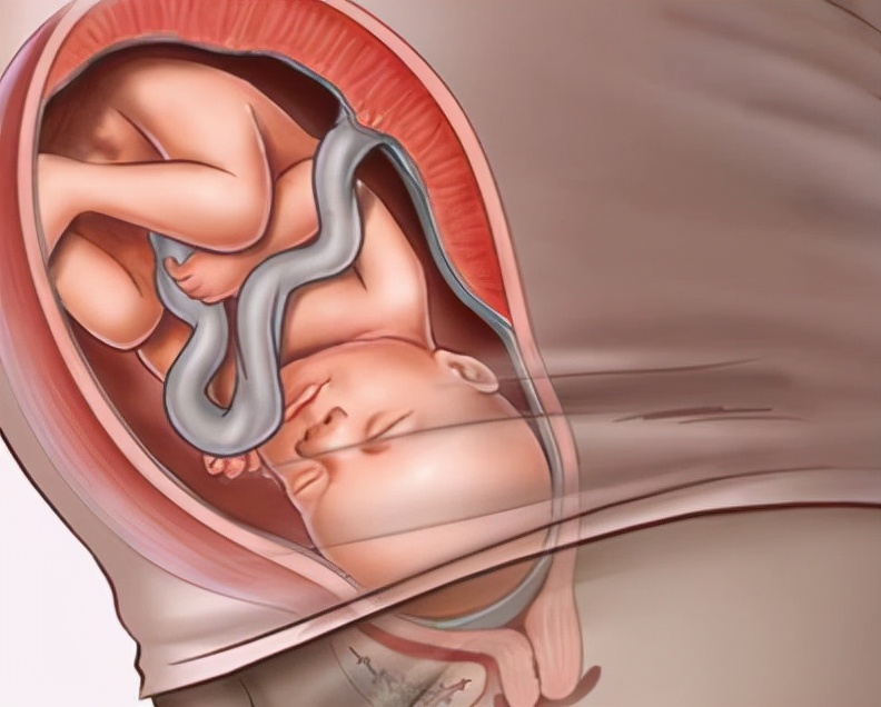 孕后期心情焦虑是因为什么,孕后期情绪会不稳定吗