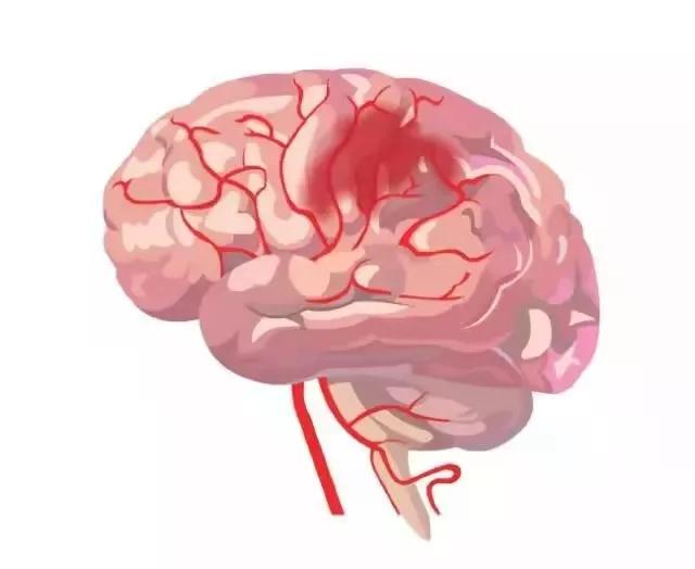 喜报！辽阳市中心医院成功挂牌国家“高级卒中中心”