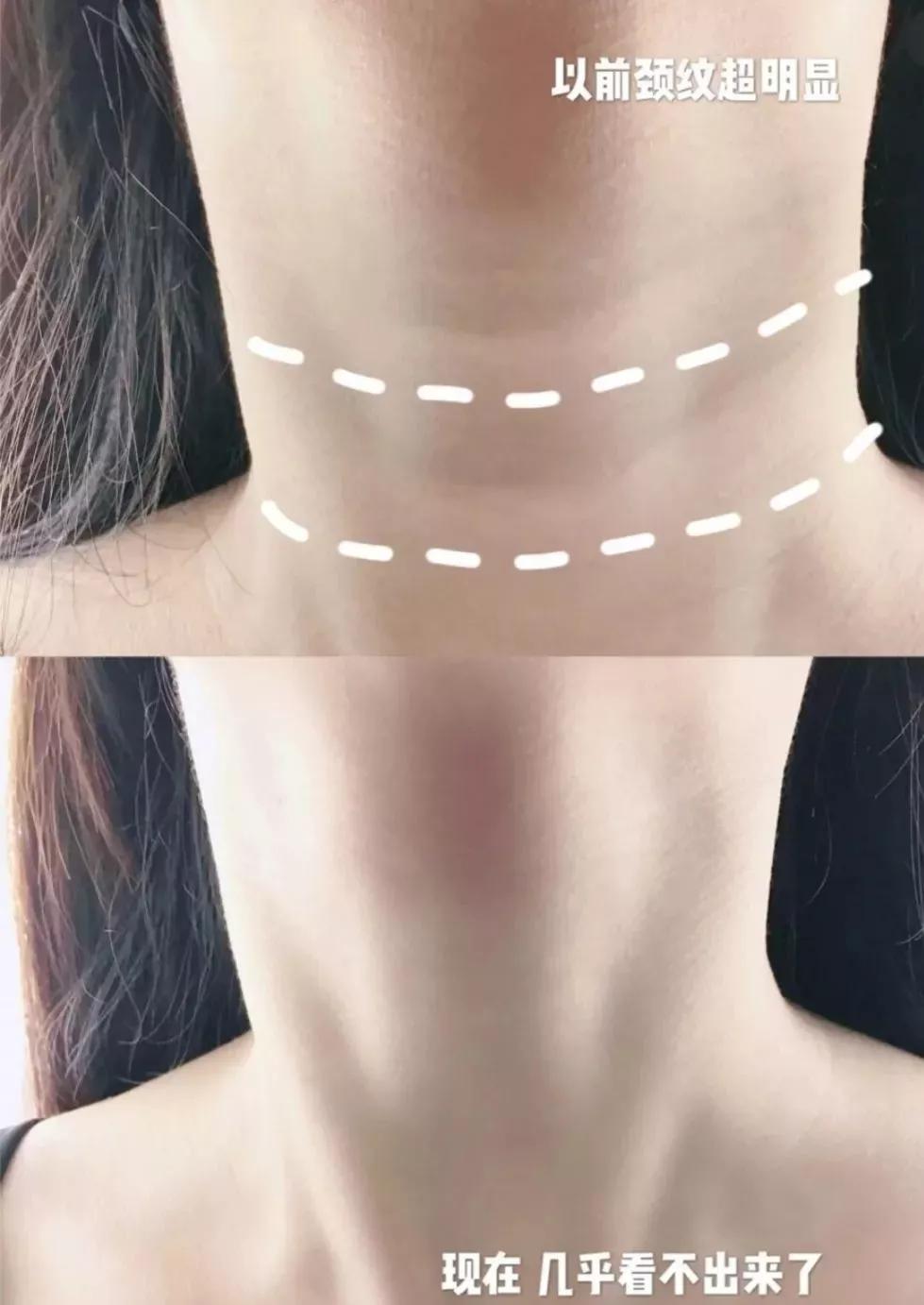 刘亦菲保养皮肤的方法,30岁皱纹多怎么修复