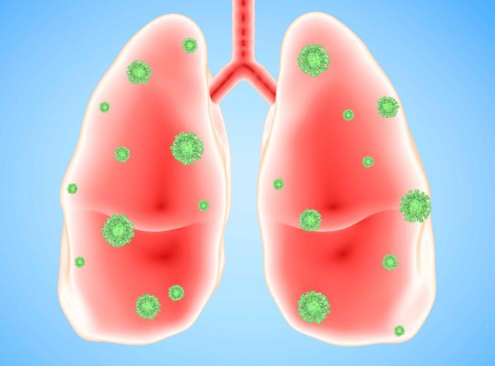 为何确诊肺炎，但白细胞却并不高？赶紧来了解一下