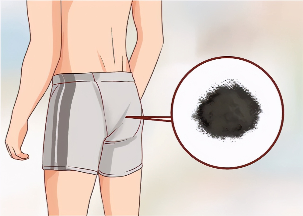 爱放屁，声音又大又难闻？8个小妙招就可轻量化，让你不再尴尬