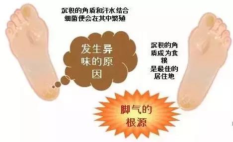 啊呀！你的脚后跟看起来糙得像位“真正男子汉”