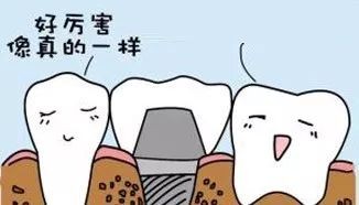 种植牙成为牙齿修复的最佳选择,种植牙是牙齿修复的最佳选择吗