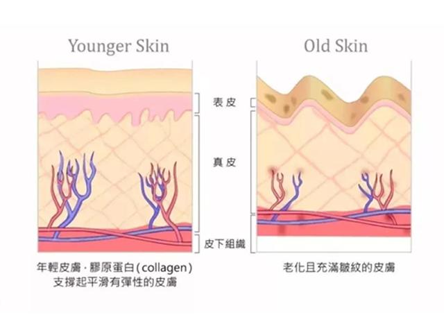 如何让泪沟消失小技巧,泪沟真的毫无办法吗