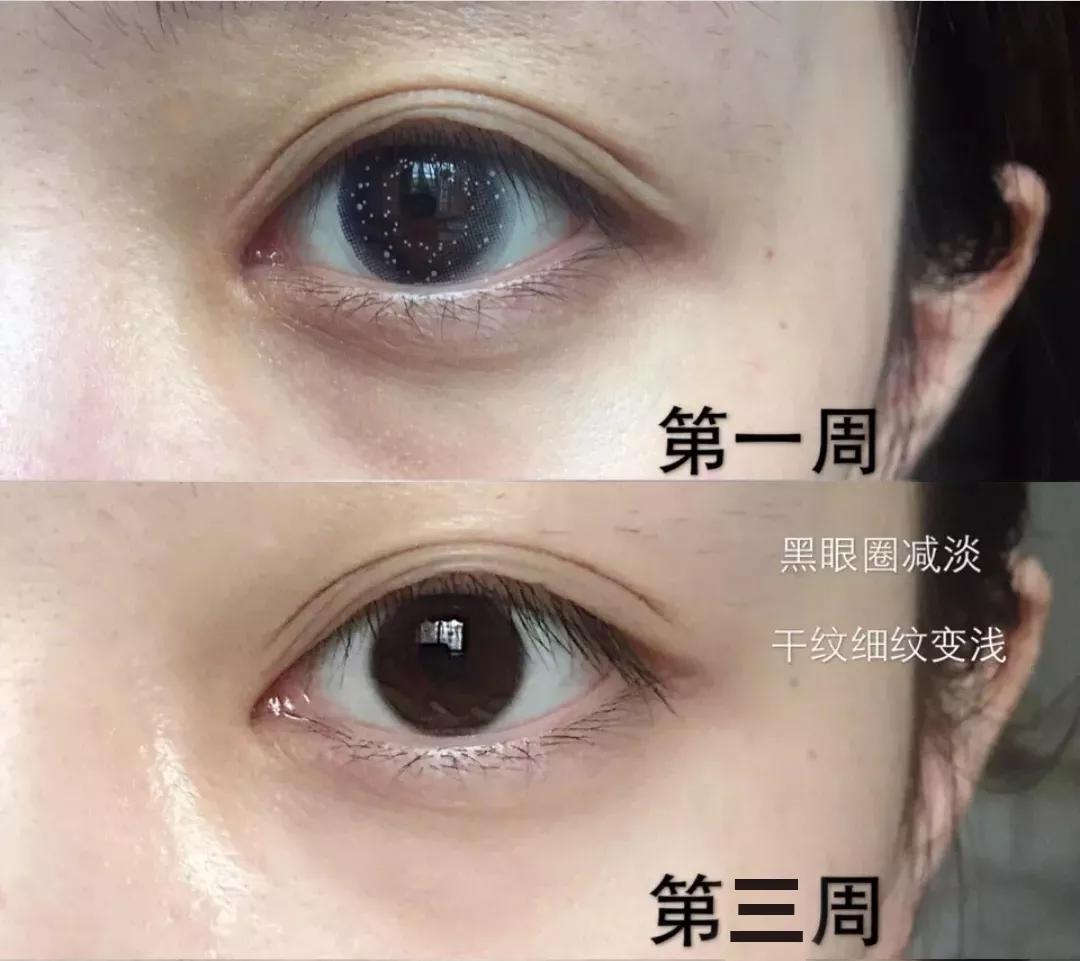 又好用又不贵的30岁以上的眼霜,25岁以上适合的平价眼霜