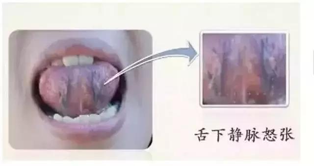 观舌识病22种舌诊图解大全,舌诊看舌头视频