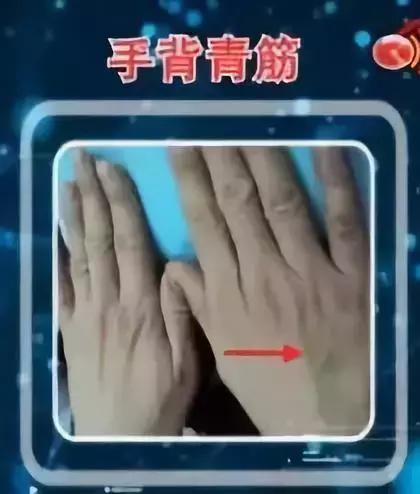 洗澡后手上的青筋暴露是什么原因,今天手上突然冒青筋是怎么回事啊