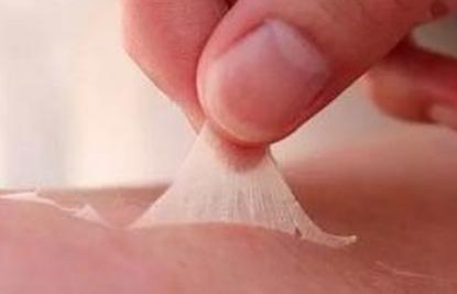 308治疗白癜风皮肤变黑怎么办,白癜风照308后发痒是怎么回事