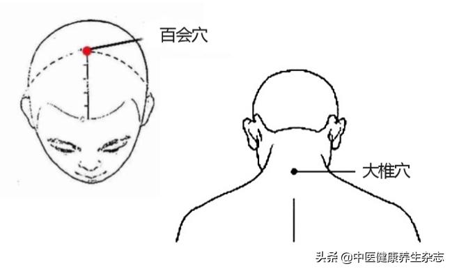 阿尔茨海默症针灸穴位取穴,阿尔茨海默症针灸穴位