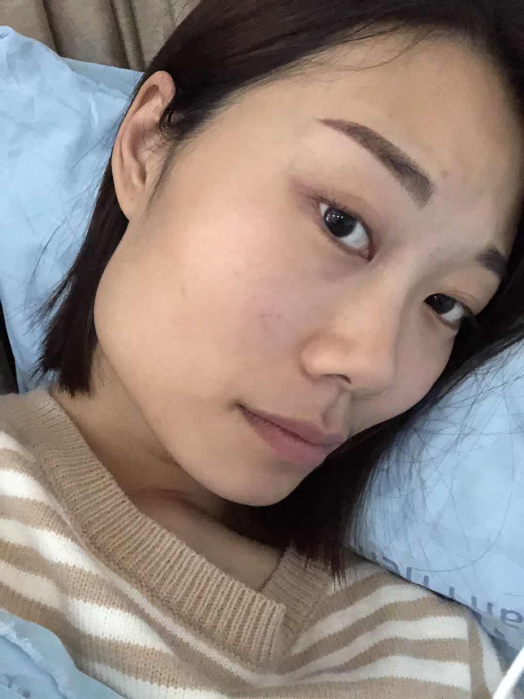 5万整容手术成功案例,女子花50万整容变毁容