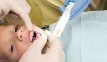 有牙洞用含氟牙膏,牙齿涂氟小知识