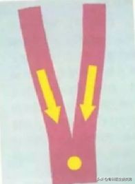 肌内贴测评,李宁国货引发争议