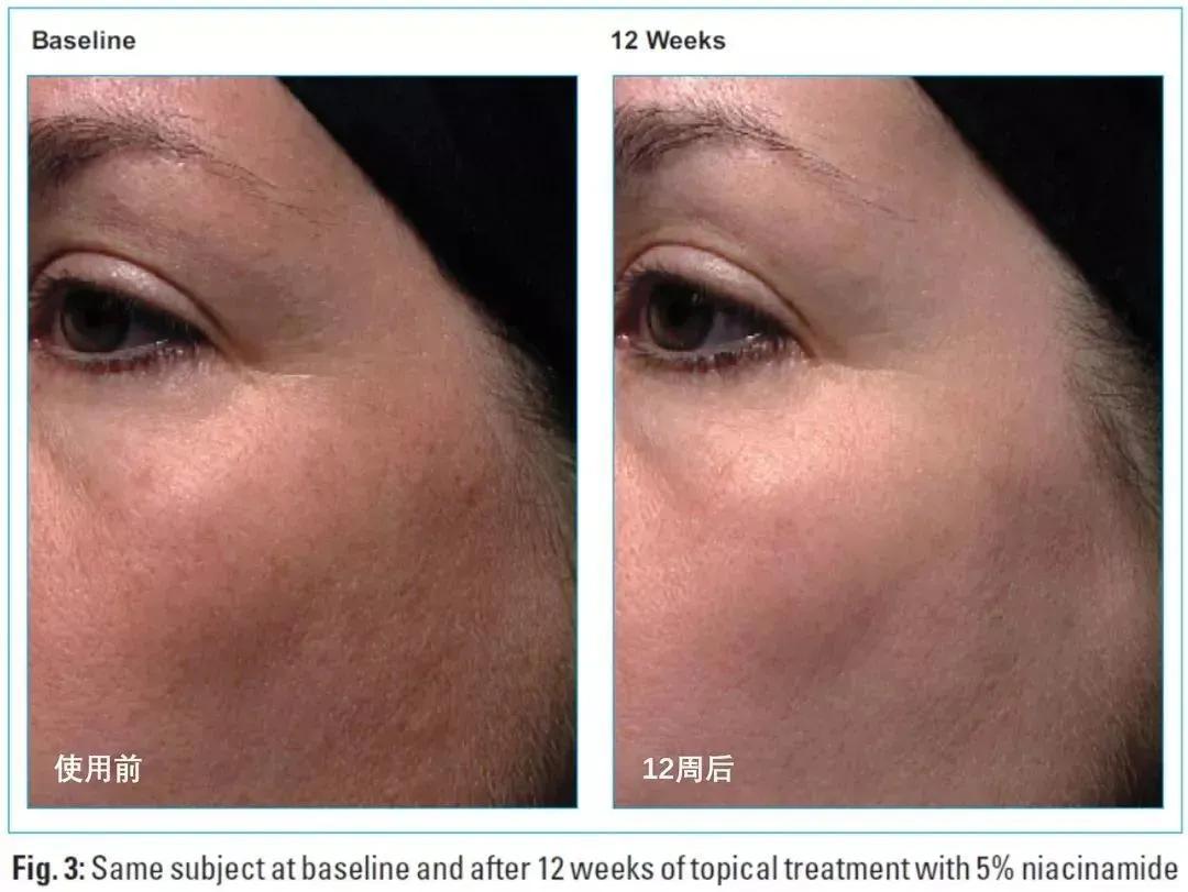 烟酰胺美白精华正确使用方法,烟酰胺美白饮怎么喝