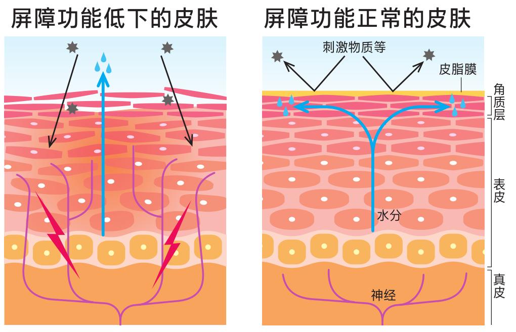 呵护脆弱肌肤,抗皱补水保湿水美素