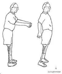 简单的截肢方法,截肢物理治疗