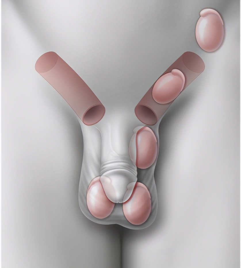 男孩一出生就失去一只眼睛,男性隐睾是先天还是后天的