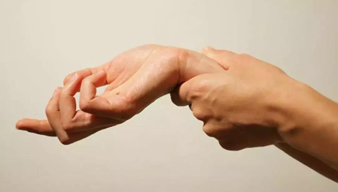 腱鞘炎引起的胳膊疼怎么治疗,手拇指腱鞘炎的自我治疗方法