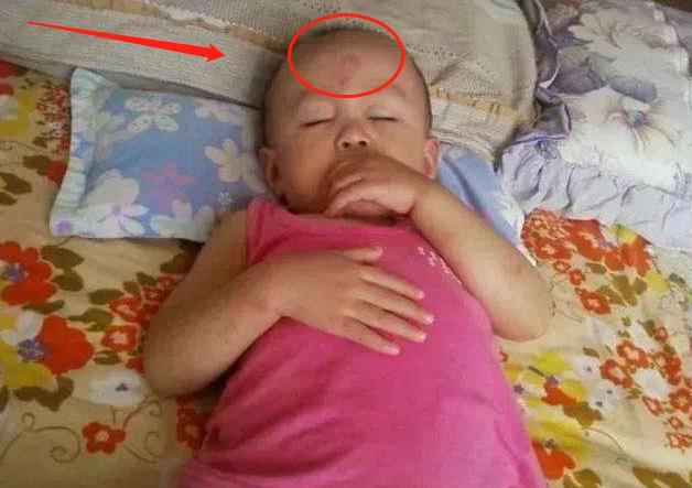 小孩摔伤后妈妈少做一件事,小孩摔伤头部该怎么做