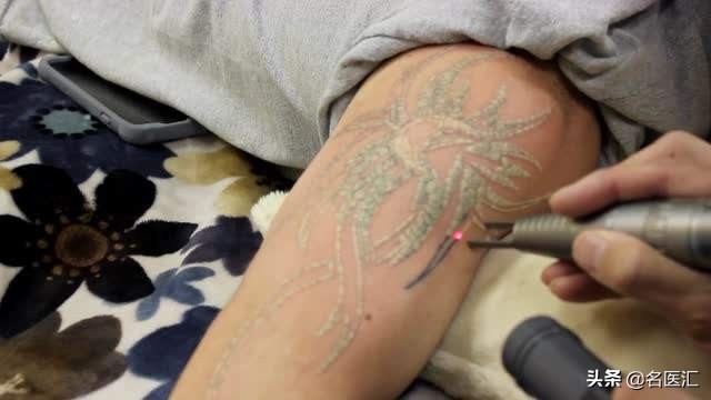 目前最好的洗纹身方法,目前最好的洗纹身的方法