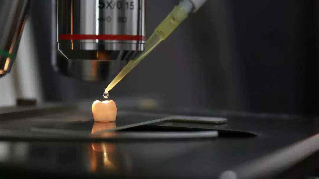 牙齿牙釉质缺损的修复方式,牙齿缺损自己修复