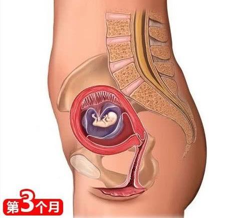 肚子下坠感是宫外孕吗,肚子下坠感是排卵了还是没排