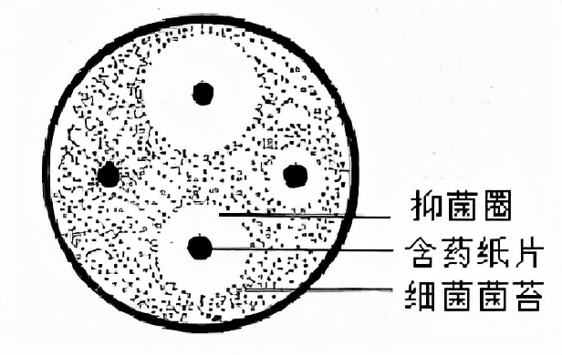 药敏是查什么的,药敏报告是怎么检查