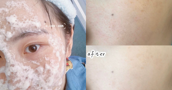 国货淡化痘疤面膜,消炎淡化痘疤修复面膜