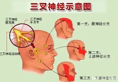 脑瘤导致的眼皮睁不开,眼皮老是抬不起来想睡没精神