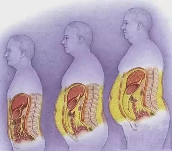顽固性腰痛怎么治愈,困扰多年的腰疼问题终于搞清楚了
