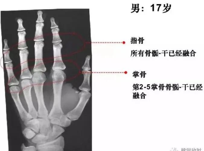 孩子个子高却跑不快,孩子个头不高怎么办