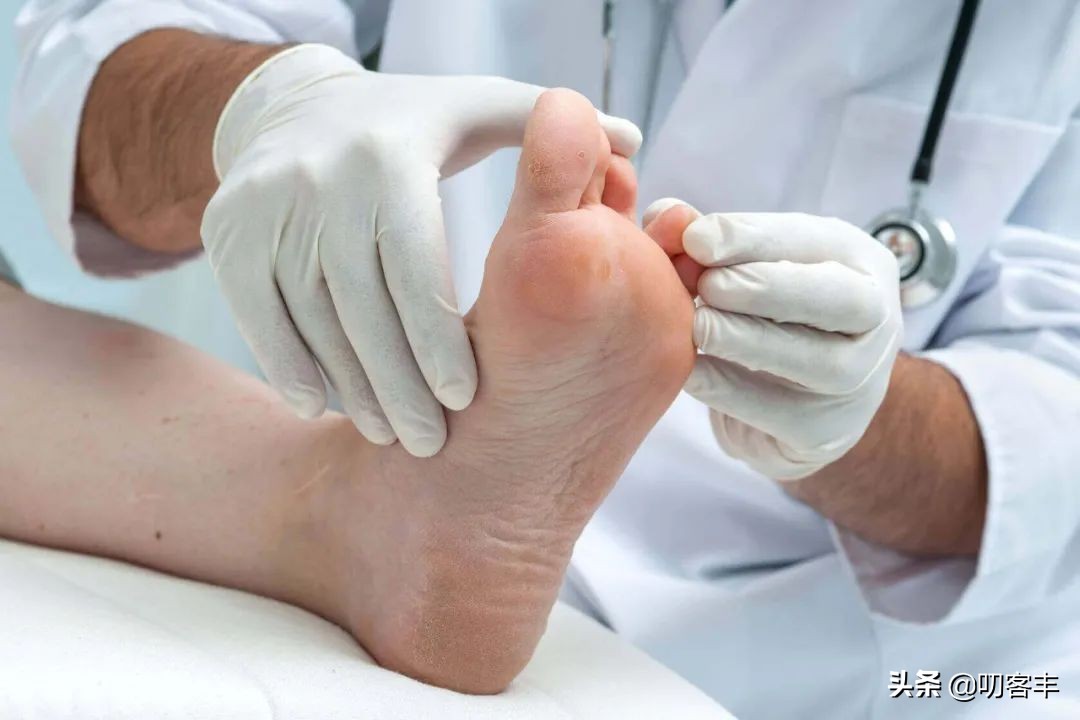 脚气怎么避免传染给孩子,孩子得脚气了怎么办