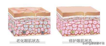 兰蔻抗皱纹眼霜,兰蔻第七代抗蓝光眼霜