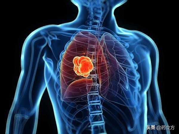 慢阻肺是什么?慢阻肺的危害,慢阻肺的治疗方法及如何预防