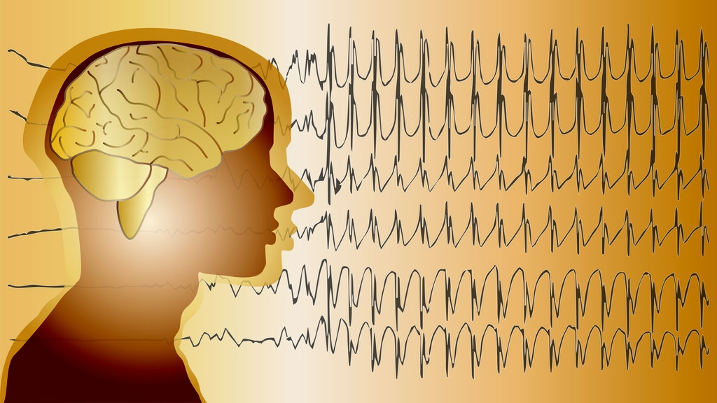 羊癫疯的症状及治疗方法,成人羊癫疯怎么办