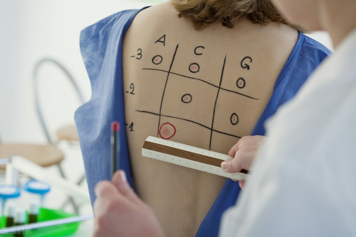 过敏越来越多谁之过,过敏背后的真相