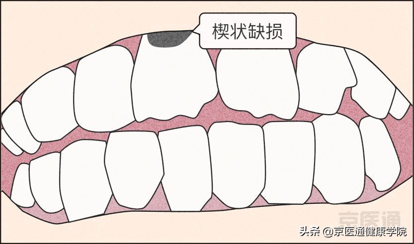 夜磨牙有什么危害吗,夜磨牙的危害