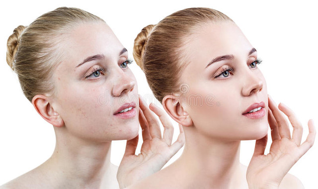 面霜推荐排行榜淡斑美白,美白补水淡斑面霜排行榜