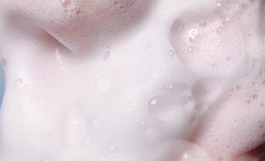 头发一天不洗就很痒有很多头皮屑,头发洗了一天头皮就很痒怎么回事