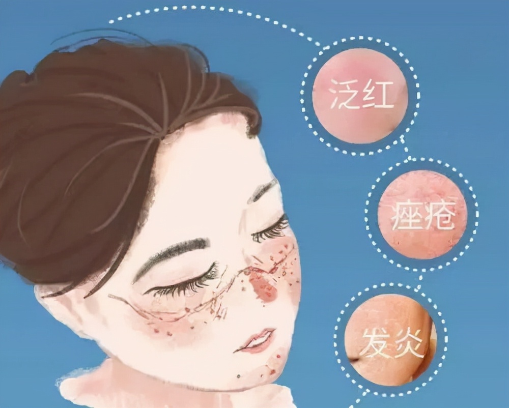 冬季玫瑰痤疮,供暖如何预防暖气病