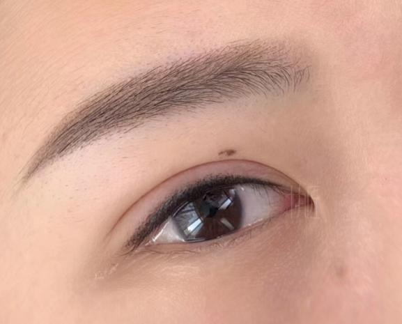 美瞳怎么处理视频教程,美瞳正确处理方式