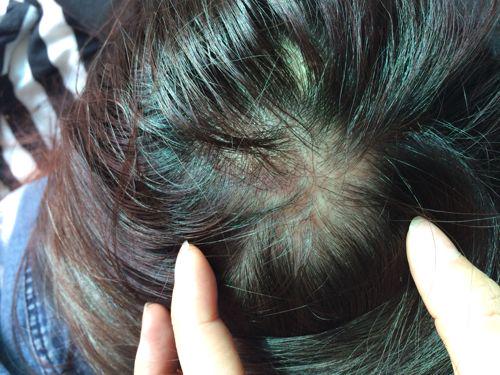 专治大油头的洗发露,拿什么洗发水拯救你的油头