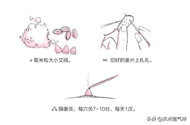 艾灸疏通肝脾肾三经,艾灸治三尖瓣反流