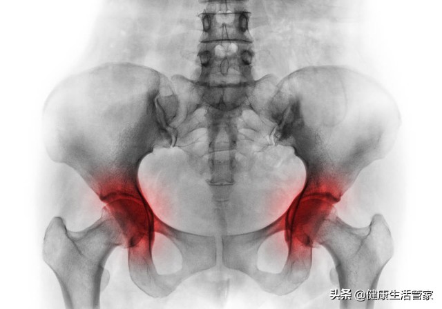 治疗股骨头坏死的中成药,董氏奇穴治疗股骨头坏死