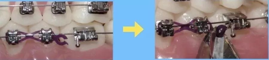 非常时期措施,非常时期保护自己