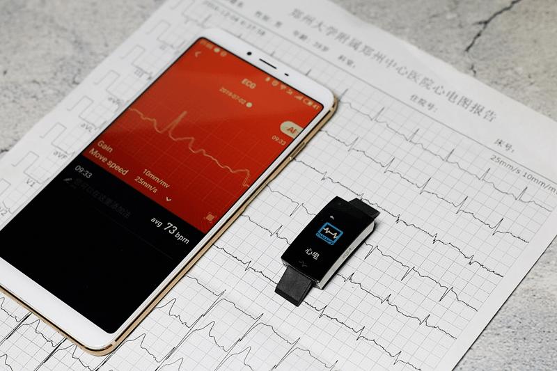 埃微i7e血压手环多少钱,埃微手环测评