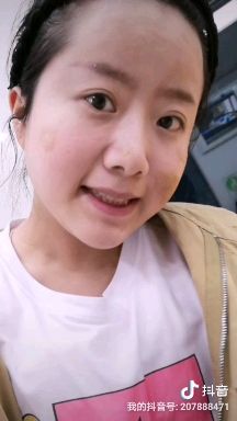 陈金西细胞种植可靠吗,陈金西细胞再生技术疤痕修复