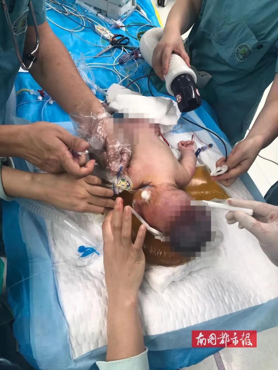 心疼生完二胎的妈妈,心疼妈妈生产的宝宝